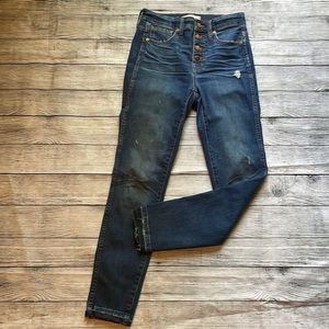 Madewell High-Rise Button Front Skinny Jeans